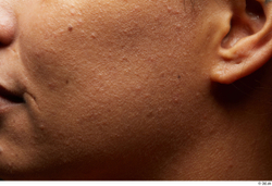 Face Cheek Ear Skin Woman Scar Chubby Studio photo references